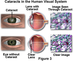 human vision figure3