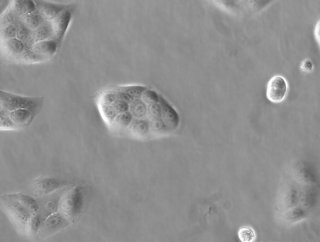 MDCK_cells_in_phase_contrast_korr_05_aaab9b6b68.jpg