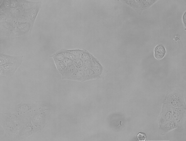 MDCK_cells_in_brightfield_korr_03_e861b8ae98.jpg