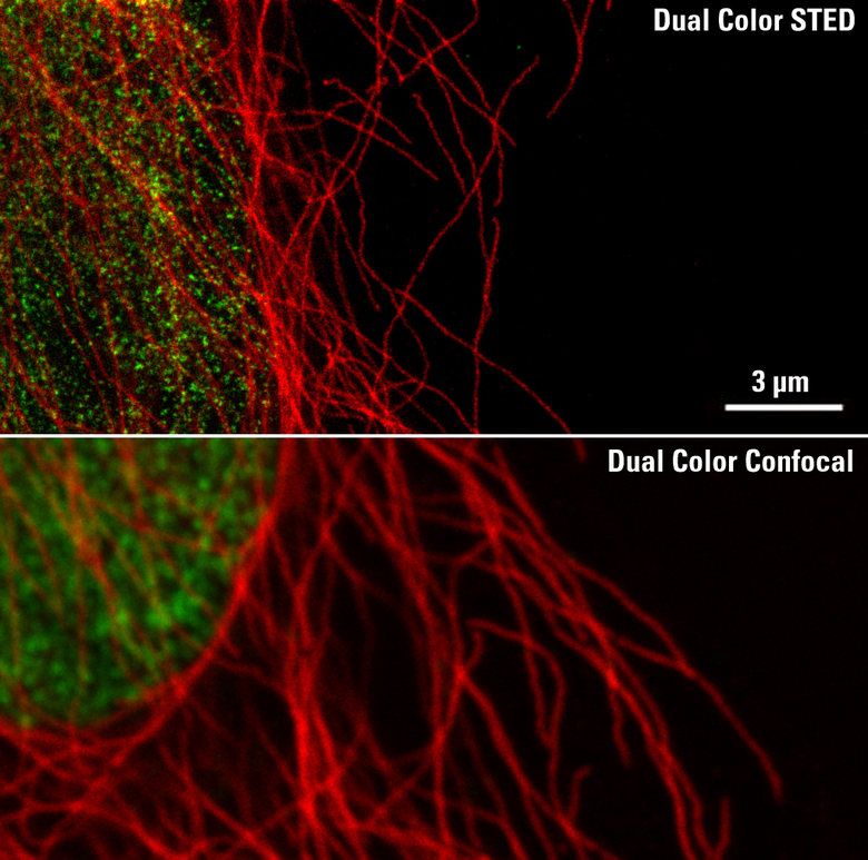 STED_CW_Conf_Comparison2